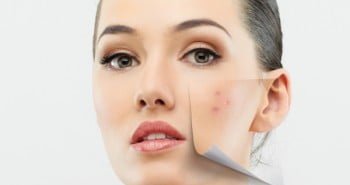 home remedies to fight skin pigmentation 350x250
