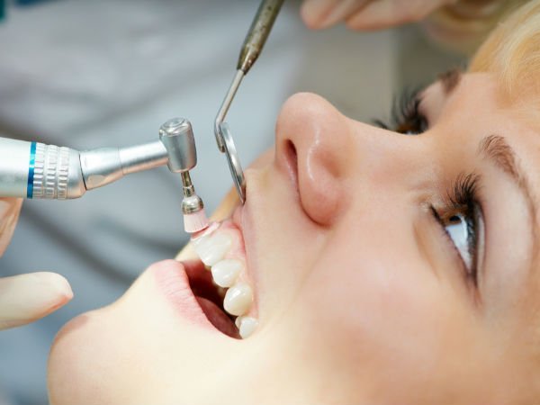 03 1454483666 15 teeth reparing