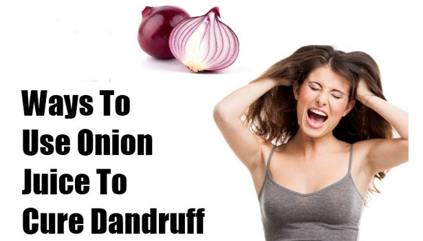 201612171003013105 Onion juice will give the solution to dandruff SECVPF