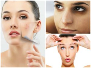 skin problems 03 1488528259 300x225 1