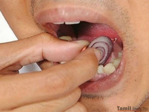 healthbenefitsofplacingonionsliceunderteeth 30 1485754282