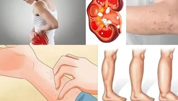 Some signs that the body is in danger