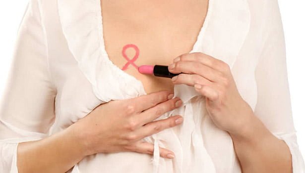 Breast Cancer