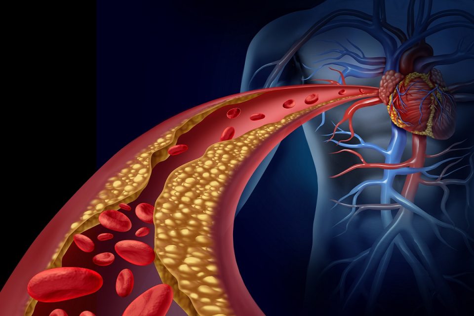 cholesterol