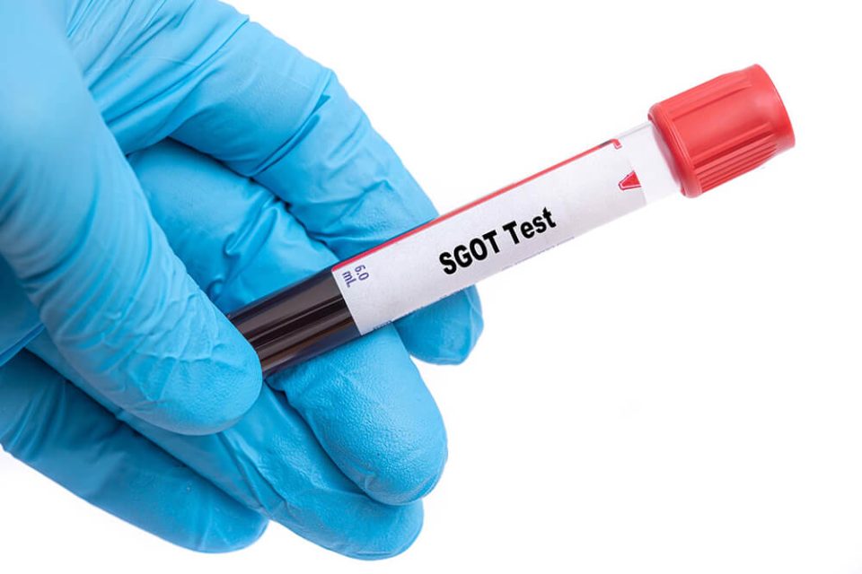 What Is SGOT Test And When Should You Go For It