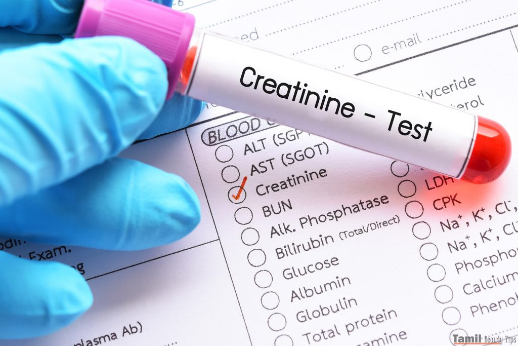 Creatinine Test High Low Normal Levels 1