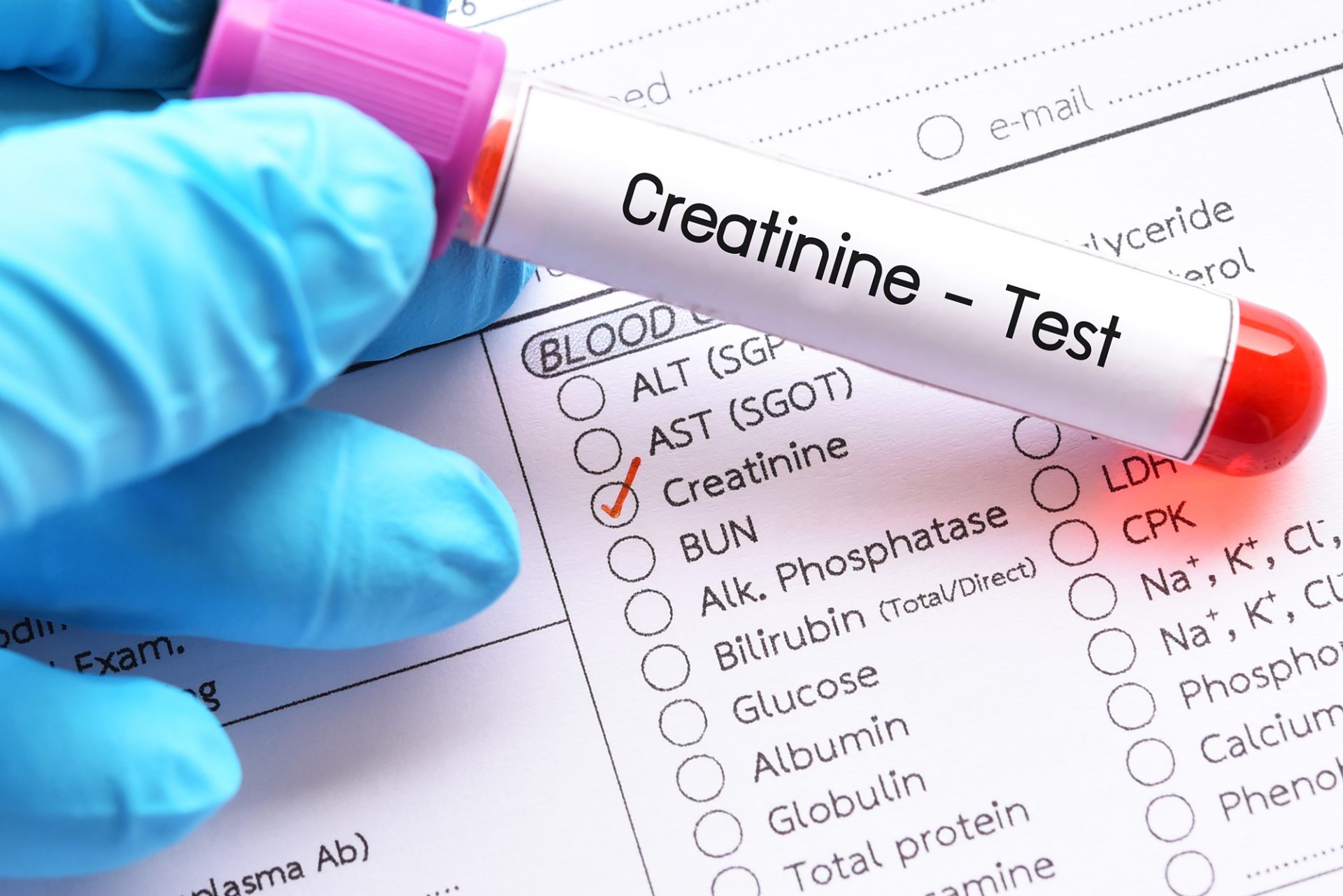 Creatinine Test High Low Normal Levels 1